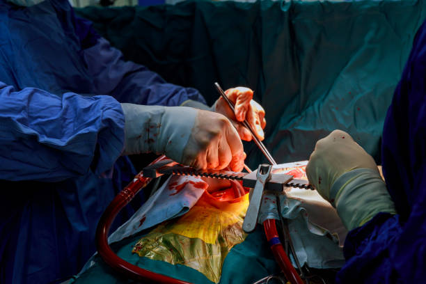 Angioplasty vs Bypass Surgery in Amritsar: Which Is Better for You?